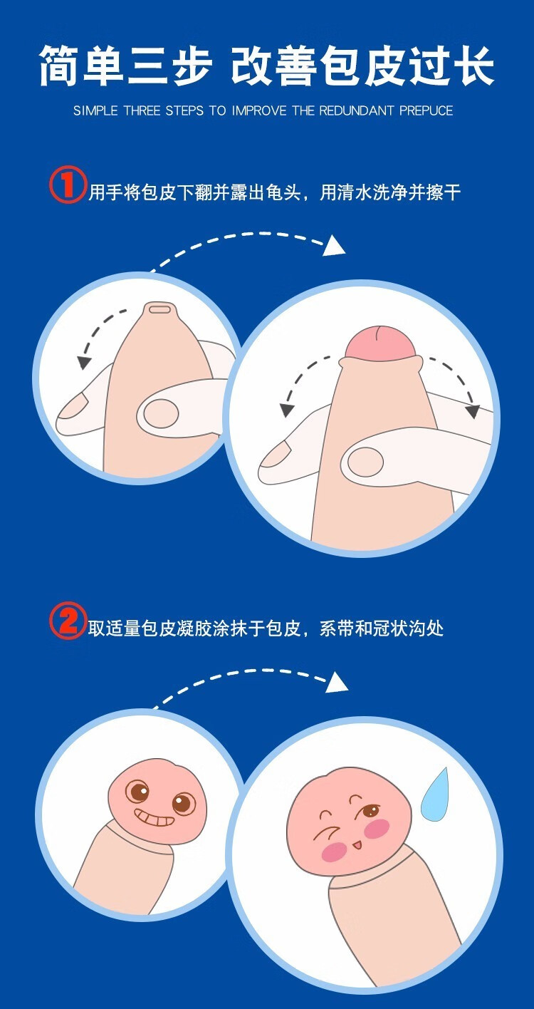 云曼 包皮阻复环锁精环包皮环切器过长矫正液器男用延持久时环包皮