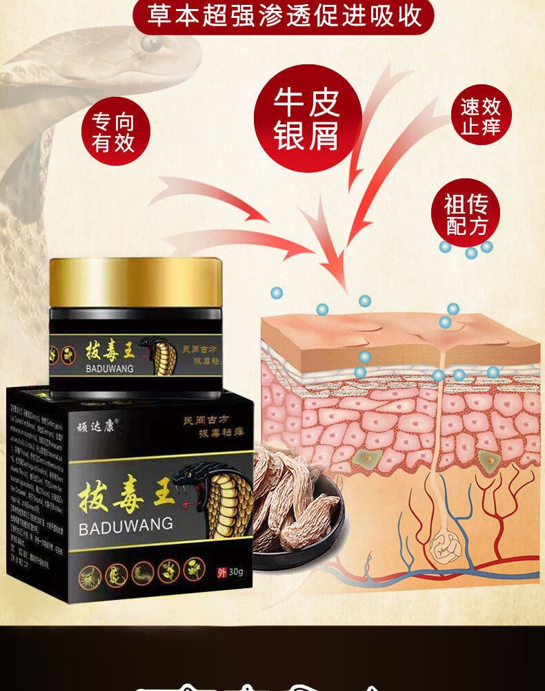 【牛皮癣银屑病专用药膏】头皮癣手足癣症皮肤瘙痒止痒特效拔毒王
