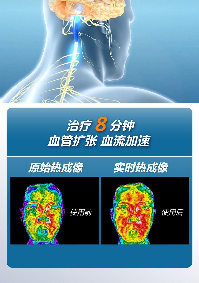 百慕迪r7高血压治疗仪心脑血管理疗仪降血压治疗仪无创无药多功能家用