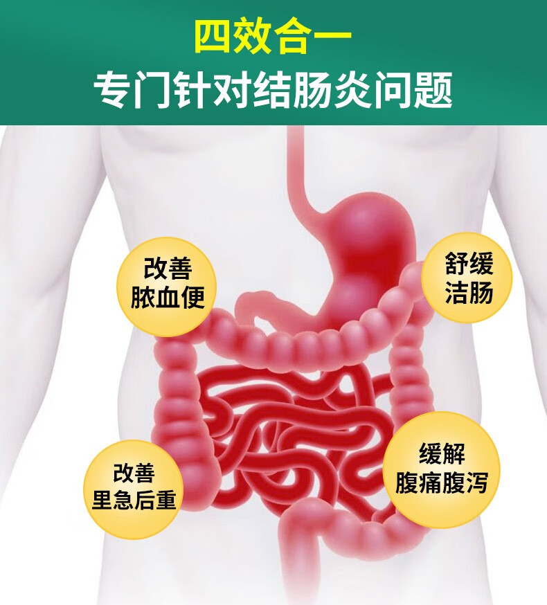 祖医堂结肠炎修复液慢性溃疡性腹痛大便次数增多粘液脓血便肛门灼热里