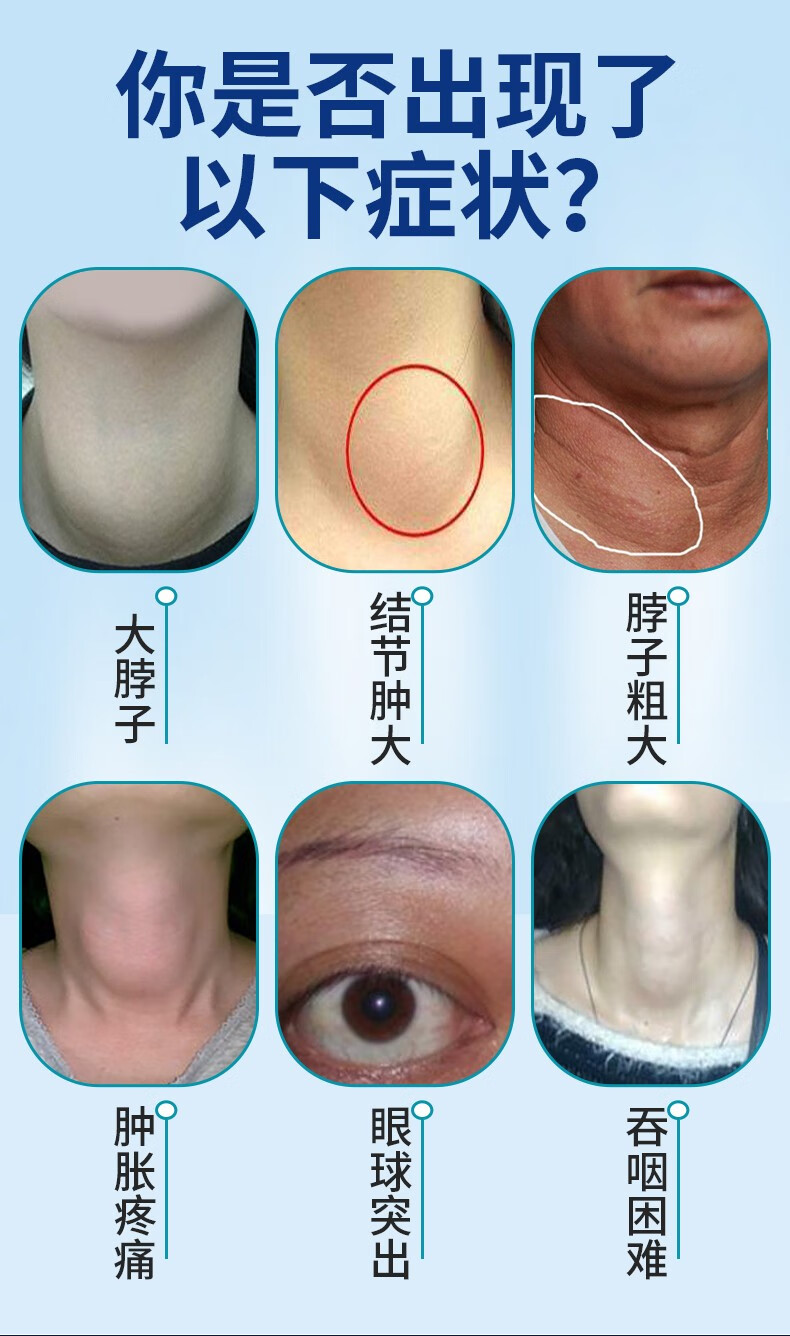 【祖医堂】甲状腺冷敷贴,甲状腺肿大,甲状腺结节,淋巴结肿大,一撕一贴