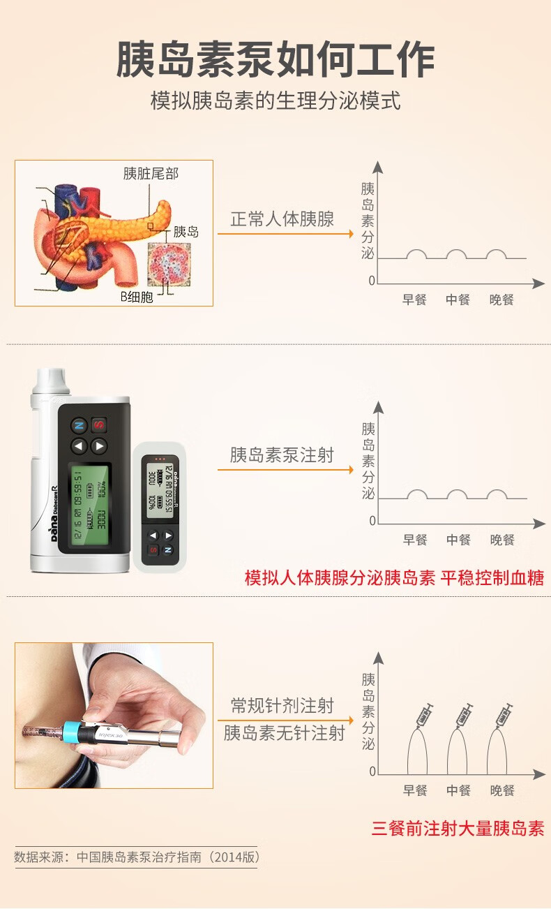 丹纳进口家用胰岛素泵danar带无线智能遥控器注射器糖
