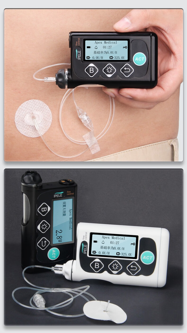 ipele艾派乐胰岛素泵获得欧美ce认证家用医用胰岛素智能连续注射器x