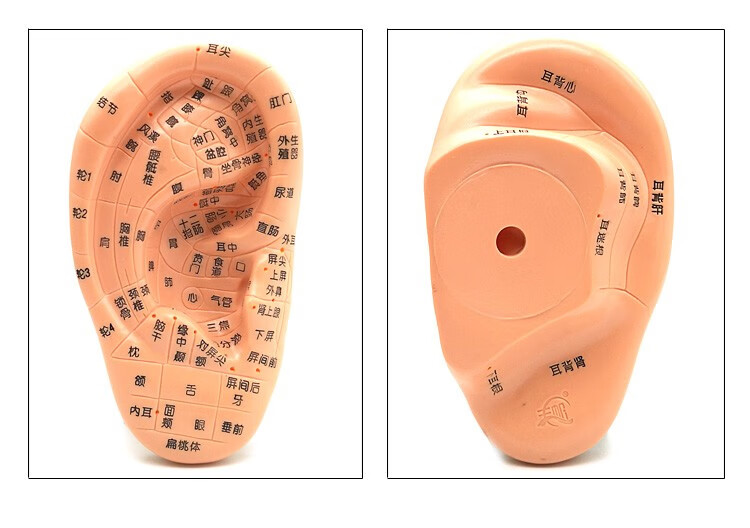 王不留行籽耳穴贴耳豆贴低敏耳穴压豆低敏胶布超薄耳穴贴耳穴模型 低
