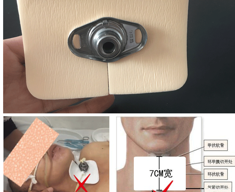 医用无菌气管切口垫泡沫敷料垫切口切开垫奇创气切纱布块开口垫气切