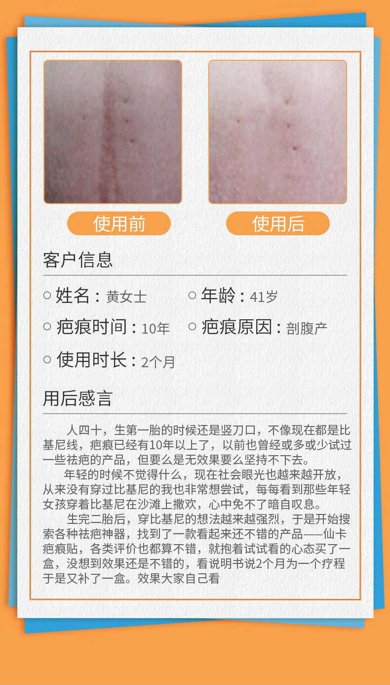 仙卡施乐辉疤痕贴医用硅酮凝胶敷料去疤剖腹产增生修复淡化疤痕贴片