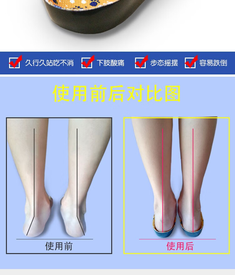 儿童内外八字矫正鞋垫xo型扁平足专用鞋垫宝宝足弓支撑垫足外翻纠正副