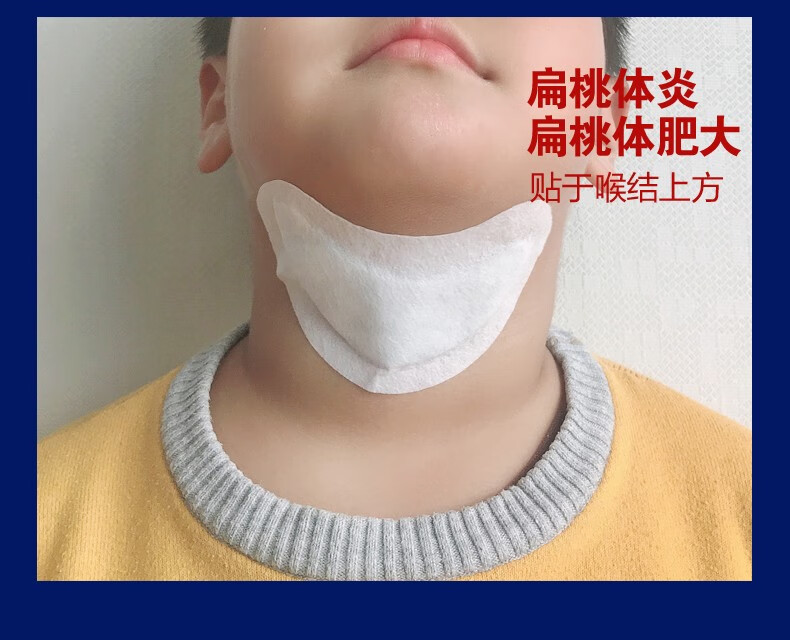 长杰 慢性咽炎贴 咽扁康医用冷敷贴咽喉贴儿童扁桃体发炎肥大贴肿痛咽