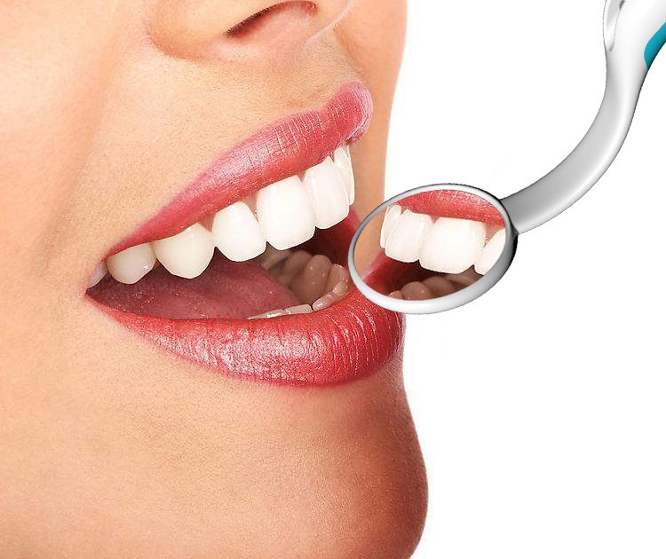 爱礼优 看牙口腔镜带灯牙镜子防雾家用口镜照检查牙齿内窥镜牙医工具