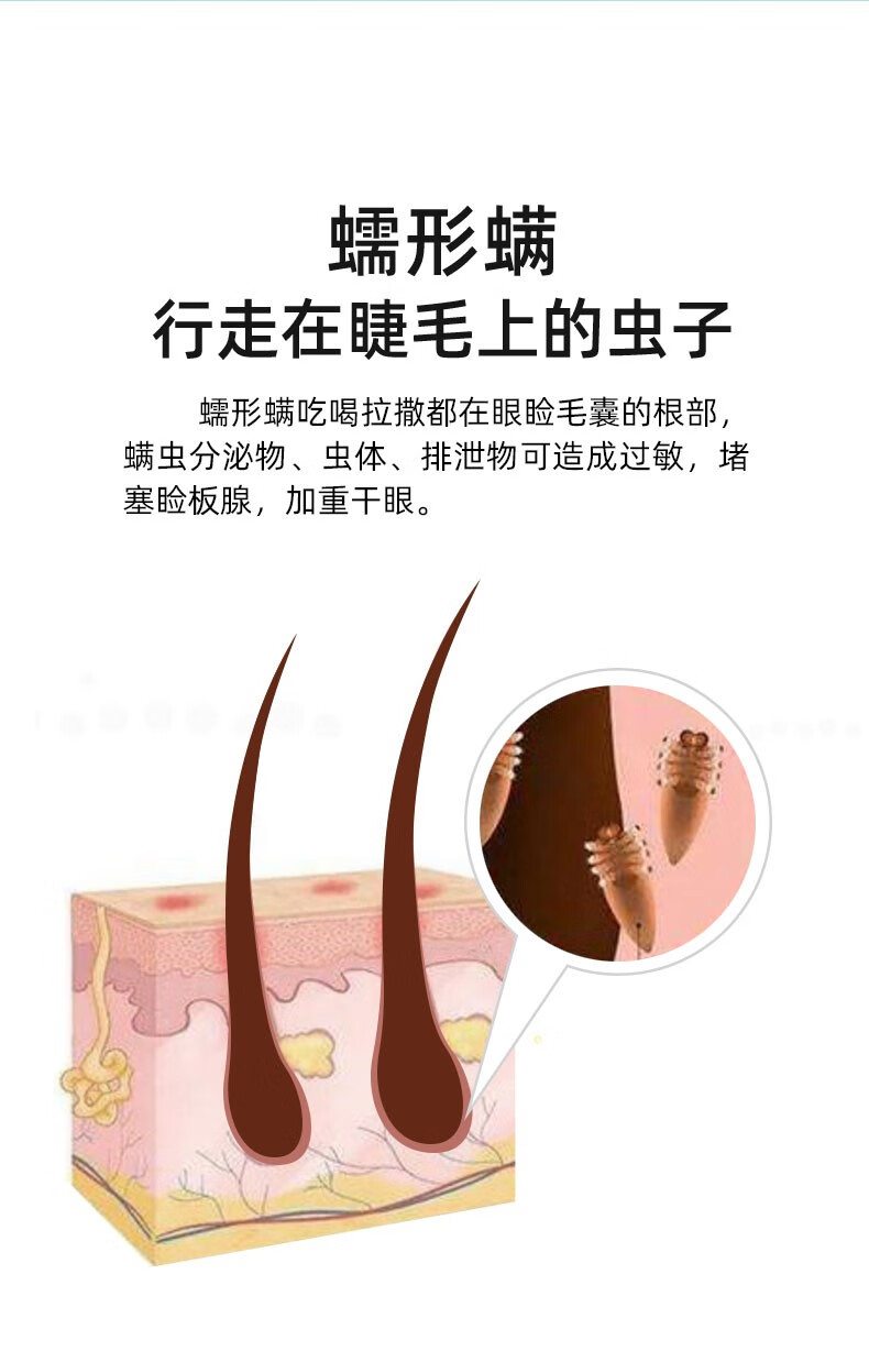 4松油醇除螨湿巾眼部专用茶树油眼贴眼睛螨虫清洁眼睑茶树精油眼贴启