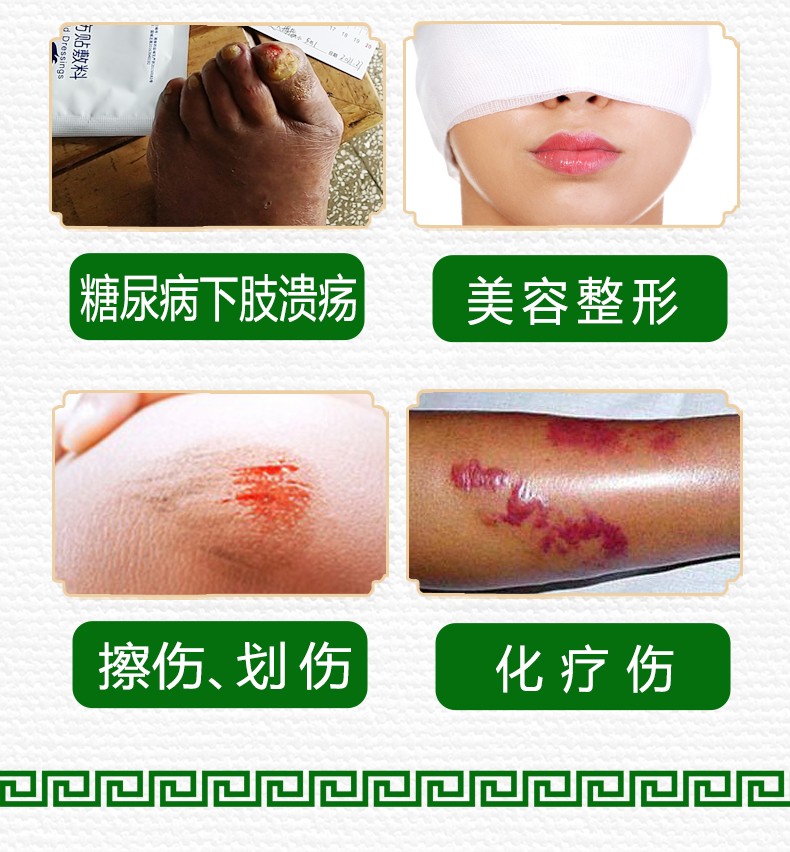 愈邦抗菌医用敷料愈邦银离子纳米银抗菌敷料烧烫伤褥疮压疮糖尿性足