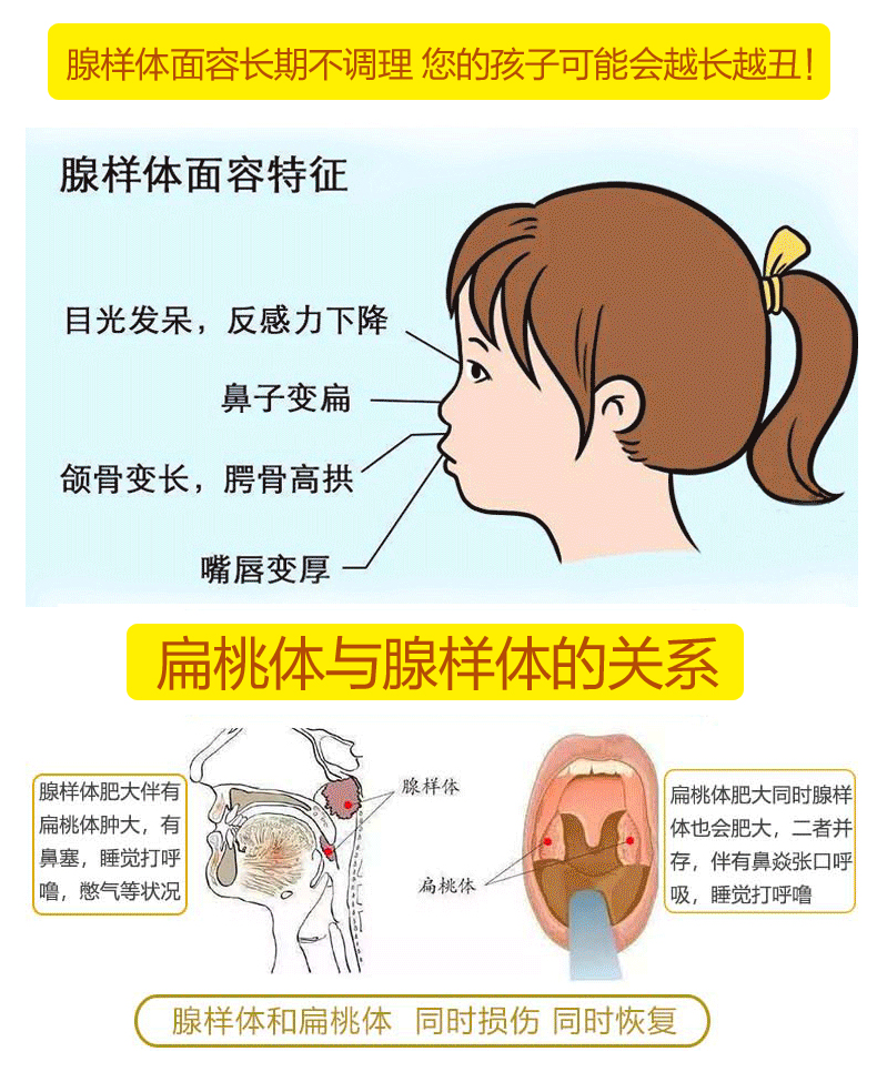 金力康 儿童腺样体肥大贴 小儿鼻塞鼻痒鼻炎贴止鼾贴感冒通气鼻贴