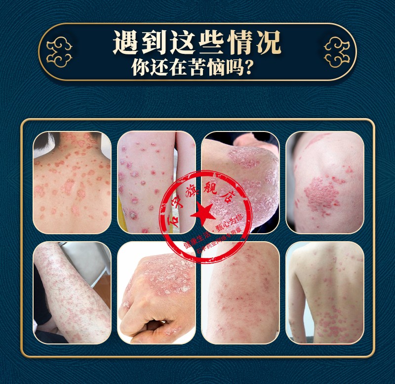 石宇金仙轻冷敷凝胶40ml喷剂20g凝胶二合一多效组合装双重出击单盒装