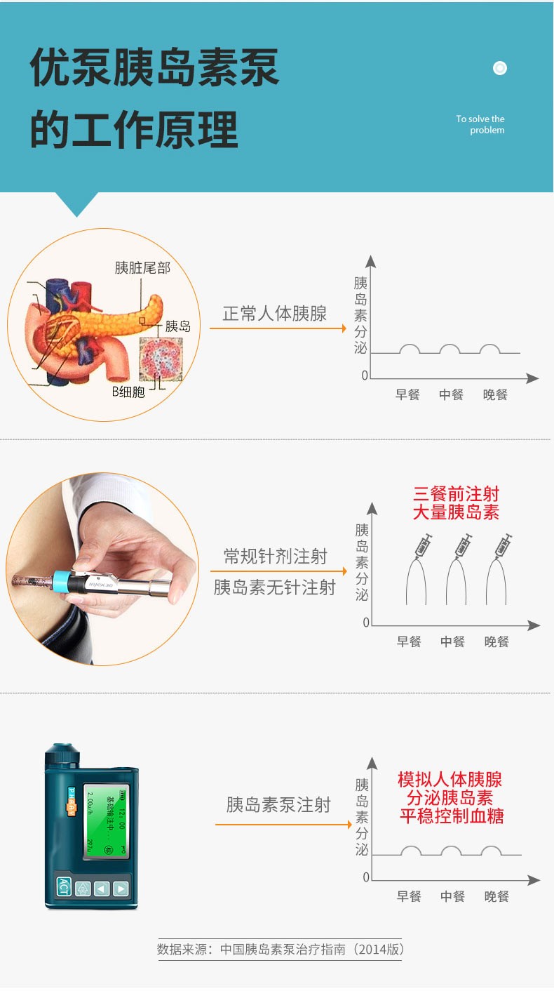 优泵 胰岛素泵ph300 家用智能胰岛素注射笔医用全自动注射器 糖尿病