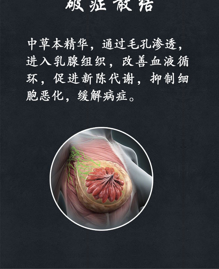 蕴祥乳腺增生贴乳腺散结硬块炎片乳房肿块痛疼小叶结节疏通副乳消奶结