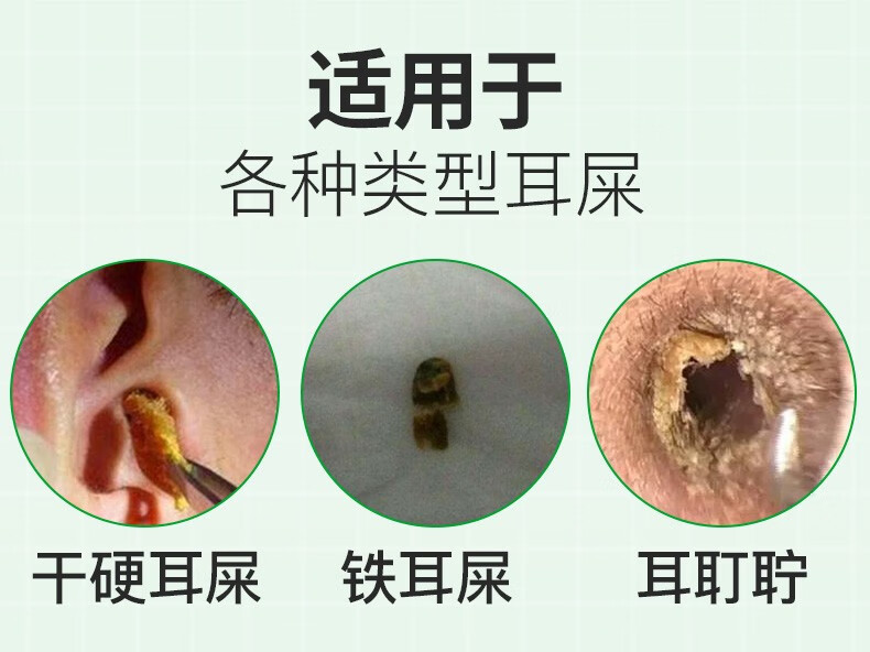 偌达wroda碳酸氢钠滴耳液4%人用耳屎软化耵聍水耳垢耳结石清洁液叮咛