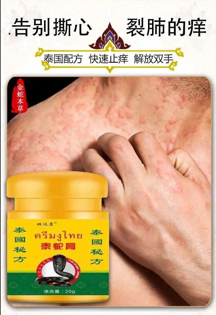 泰i蛇膏牛皮癣专用头癣股癣手足癣皮炎药 泰蛇五瓶【图片 价格 品牌
