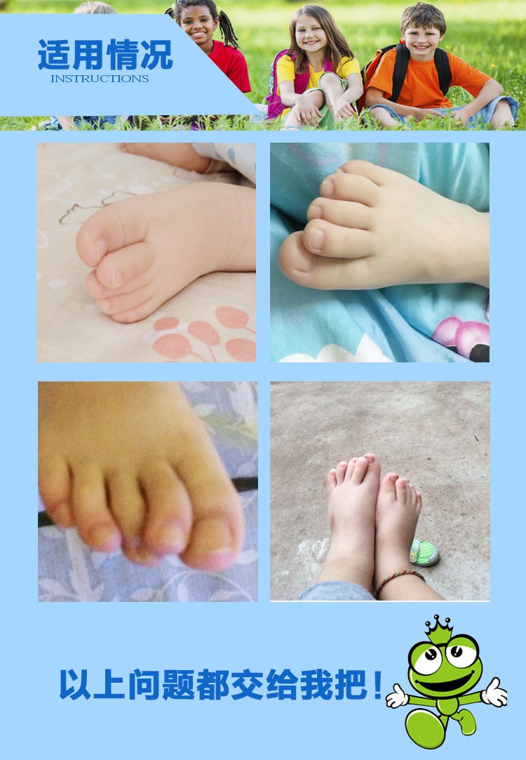 儿童拇指外翻变形纠正重叠分趾宝宝脚趾弯曲爪状趾小童器 乳白色 m4-5