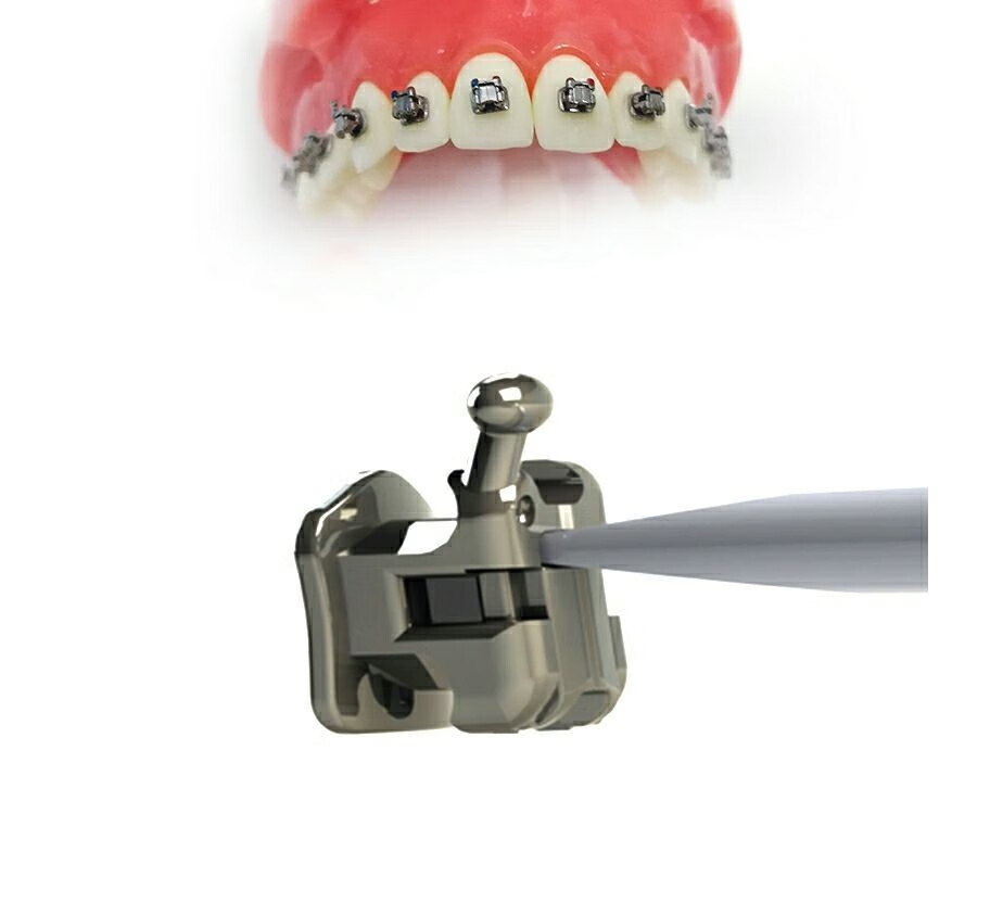 新亚星耀自锁托槽滑盖式口腔牙科新亚金属自锁被动正畸托槽包邮