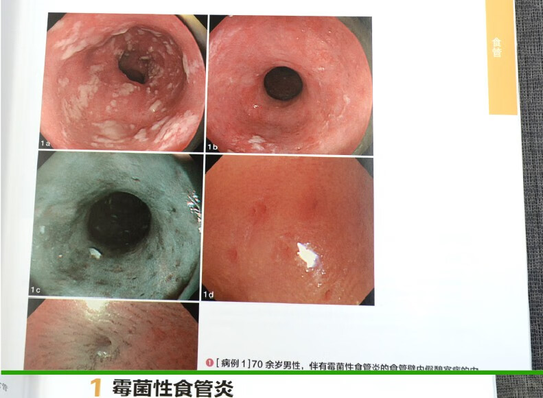 《奈特胃肠病学 第三版3版 胃肠诊断图谱上下消化道