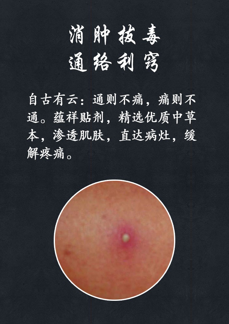 蕴祥火疖子拔毒膏疖子拔脓贴疖疮贴痘痘贴火疙瘩脓包贴坐板疮疖肿穴位