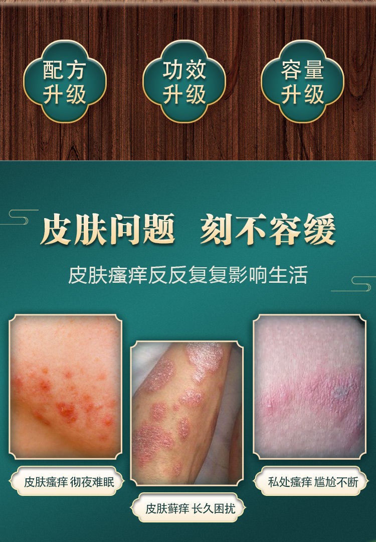【京东健康大药房】狼毒本草止痒药膏牛皮癣湿疹老年人全身干痒湿痒