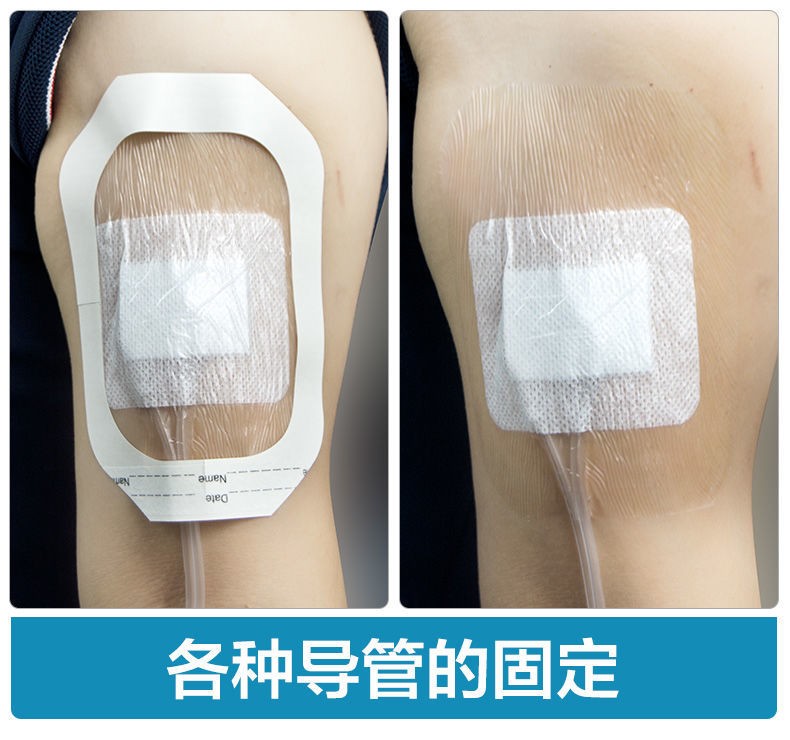 维邦透明敷料一次性医用无菌防水敷贴胸贴picc置管留置针贴膜输液敷料