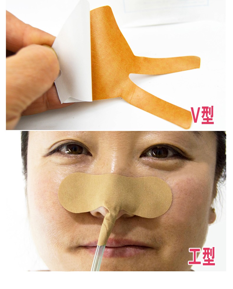 施莱康 医用导管固定贴 鼻饲胃管贴 鼻梁贴透气肤色胶贴鼻胃管专用贴