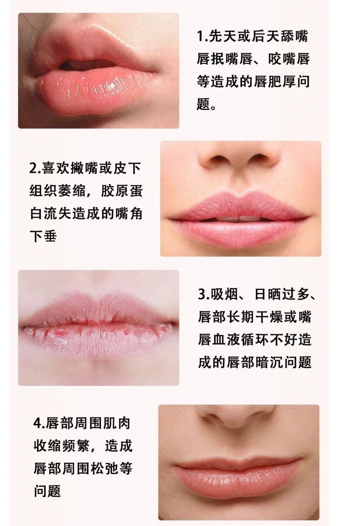 告别香肠嘴无需打针打造自然纤薄双唇厚嘴唇变薄嘴唇薄唇精油女生男生