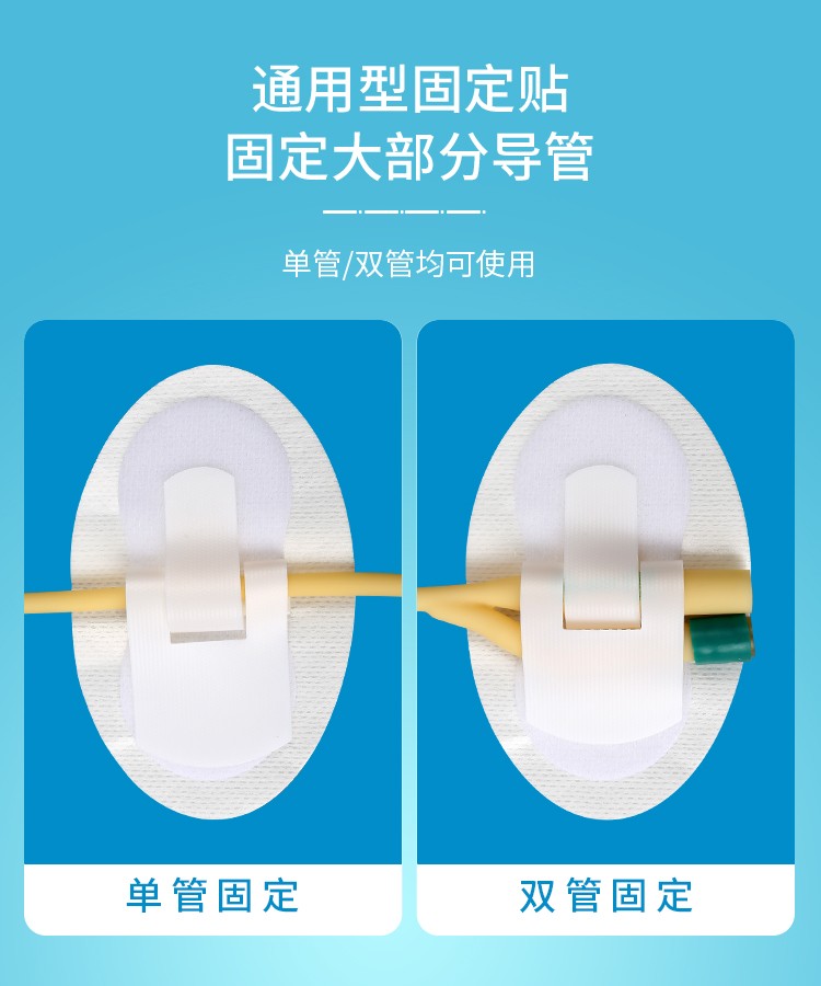 妥能导管固定贴胃管鼻饲管固定贴细导管固定贴导尿管固定贴一次性使用