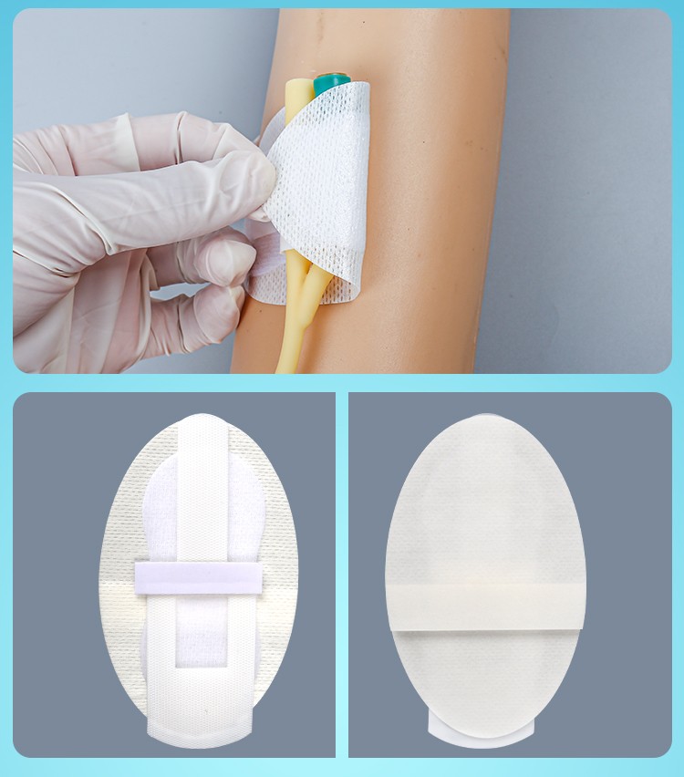 妥能导管固定贴胃管鼻饲管固定贴细导管固定贴导尿管固定贴一次性使用
