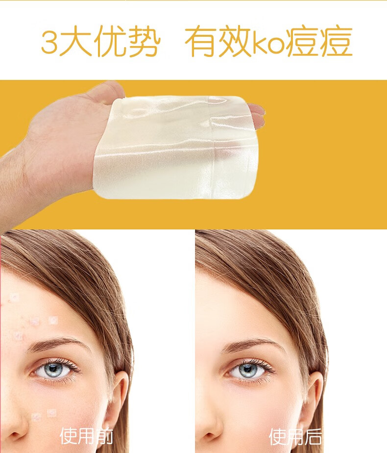 医用透明敷贴y痘痘贴亲水性人工皮伤口再生贴水胶体敷料透明隐形快速5