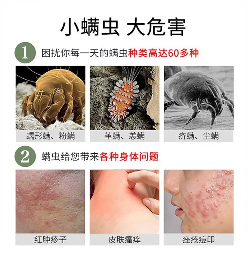 杀螨虫包贴植物除螨虫神器防螨螨立净家用免洗祛螨包用品除螨包2小包