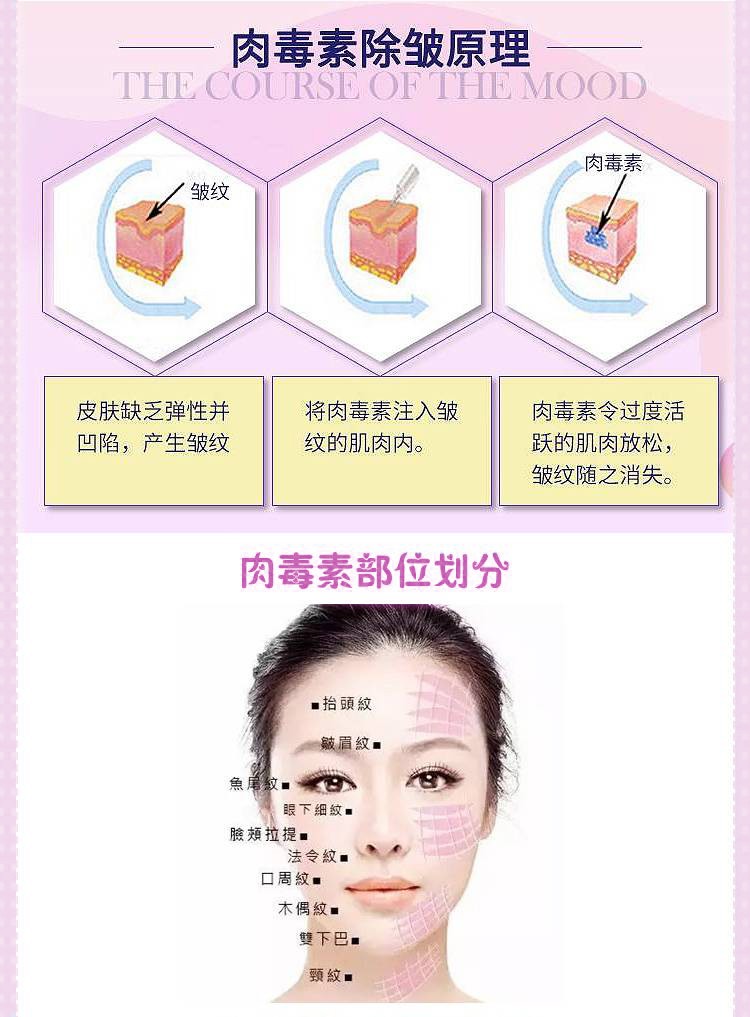 探美星选 进口除皱肉毒 抚平淡化皱纹 鱼尾纹川字纹法令纹抬头纹