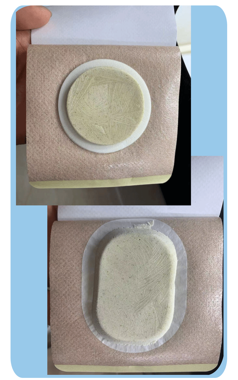 亚宝款沙蒿子透皮贴夏季白色网孔透气胶贴穴位贴防敏小儿款供诊所梓馨