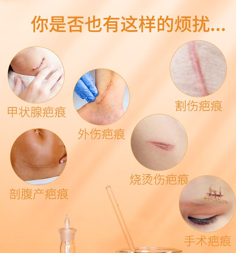 仙卡施乐辉疤痕贴医用硅酮凝胶敷料去疤剖腹产增生修复淡化疤痕贴片