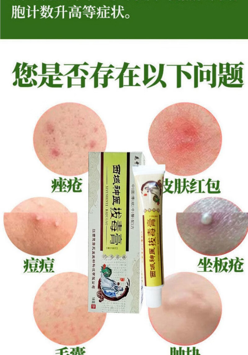 火疖子拔毒膏贴疖子脓包拔毒拔脓膏拔毒膏软膏痘痘坐板疮拨毒膏 1盒装