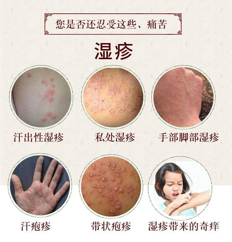 【京东药房直发】阴囊湿疹止痒去根成人专用皮肤瘙痒抑菌止痒膏湿毒