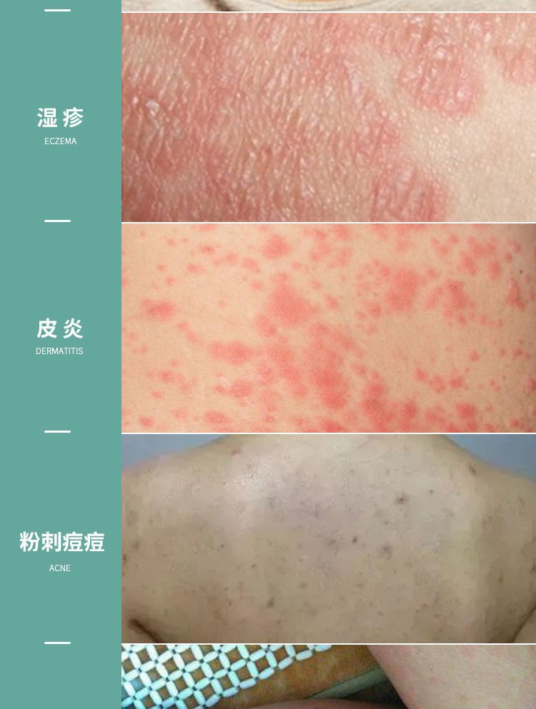 【京东药房直发】阴囊湿疹止痒去根成人艾草苦参沐浴露皮肤瘙痒全身痒