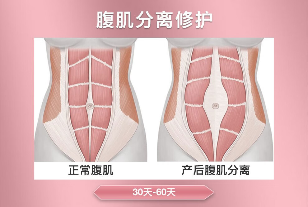 产康妇幼机构威德摩骨盆修复仪器产后收胯盆骨修复仪器收缩骨盆矫正仪