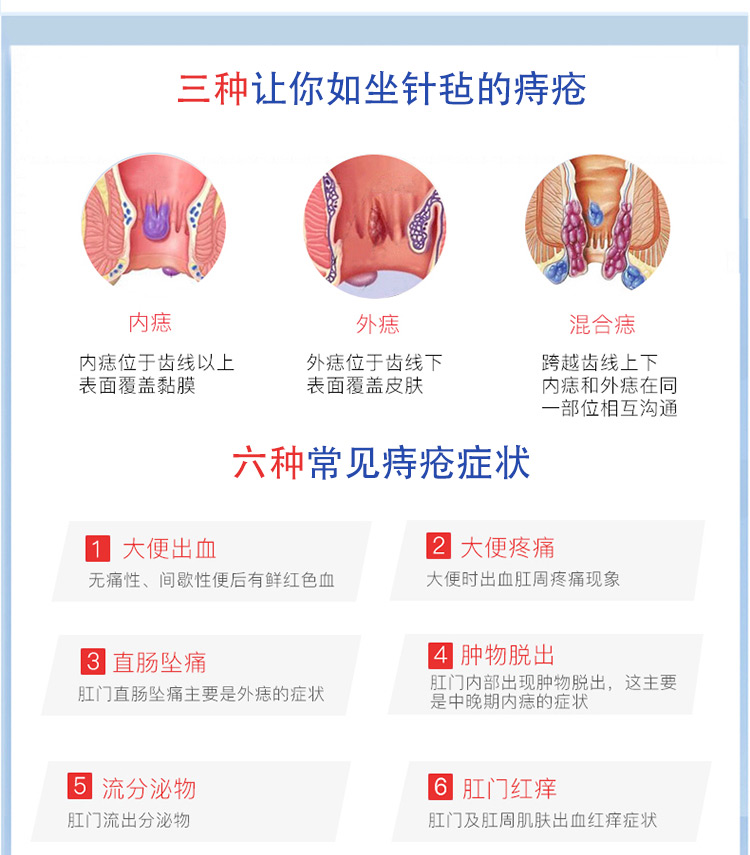 大正制药日本原装进口疮痔膏大正注入式痔软膏内外混合均适武田绿盒m
