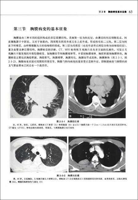 (四)奇静脉食管隐窝