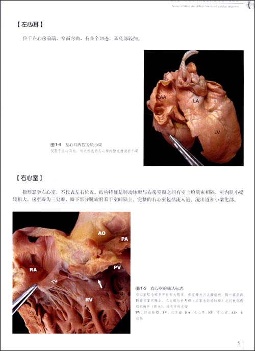 右心房位于右心室上方,右房外侧壁在游离心包腔内