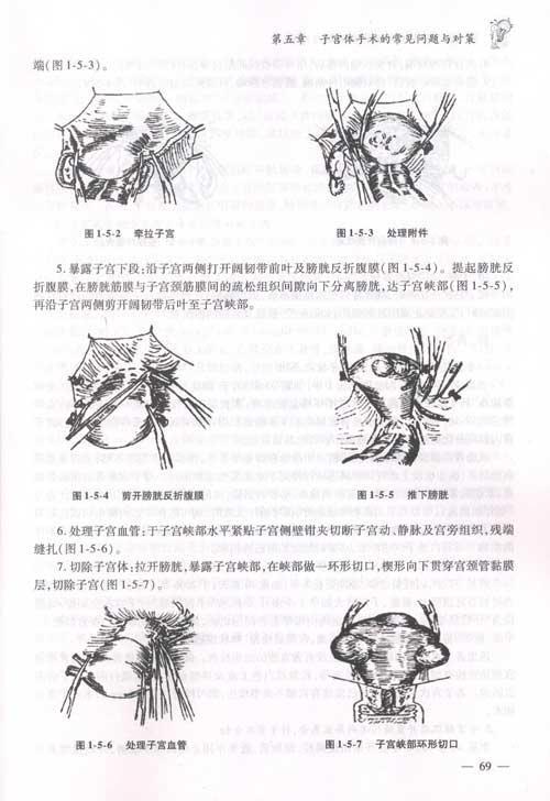 书摘插图