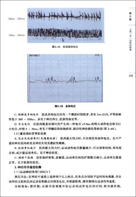 3.表面肌电信号特征在运动性疲劳中的分析