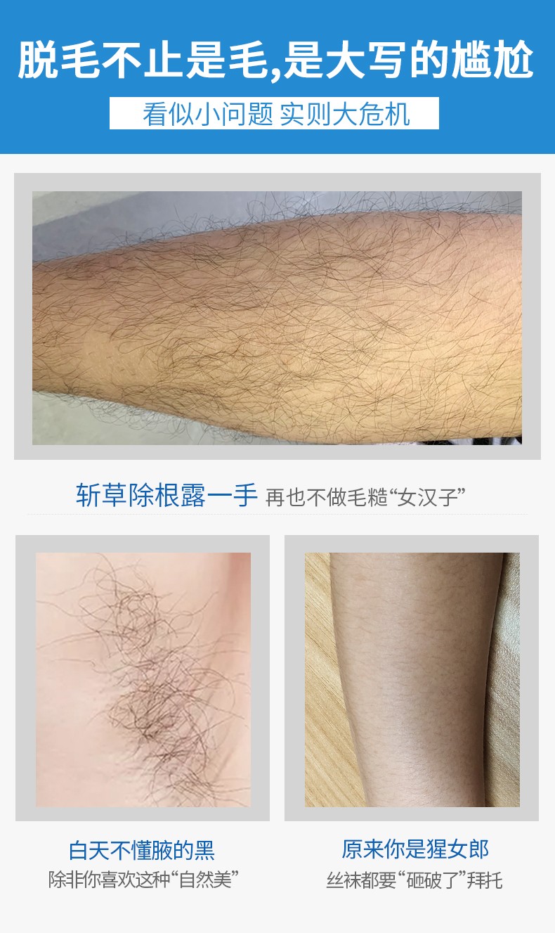 儒意脱毛膏喷雾去腋下腿毛腋毛私处男士女生专用泡沫慕斯全身去除粗毛