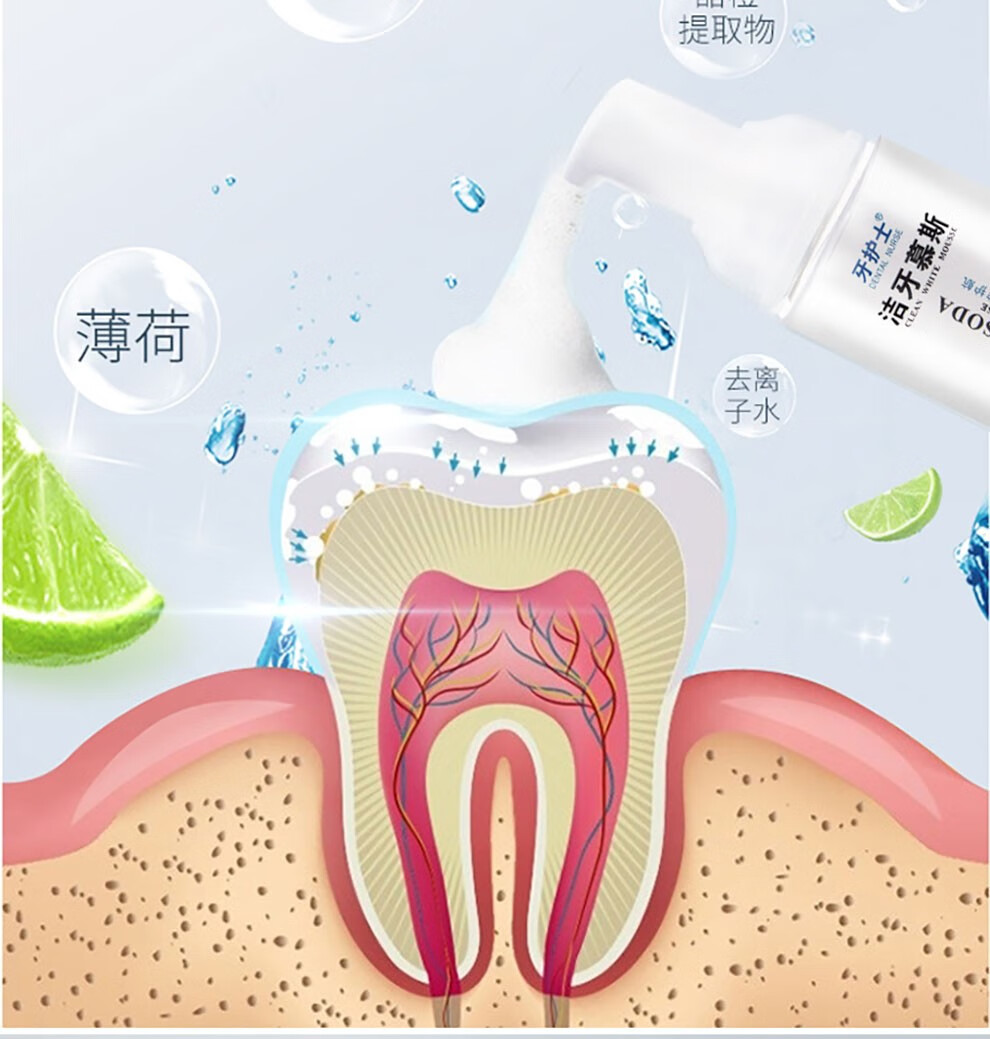 牙护士洁牙慕斯牙膏牙齿口腔清洁护理喷雾泡沫小苏打牙膏可配南京同仁