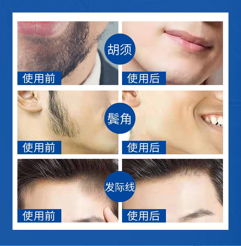 儒意脱毛膏喷雾去腋下腿毛腋毛私处男士女生专用泡沫慕