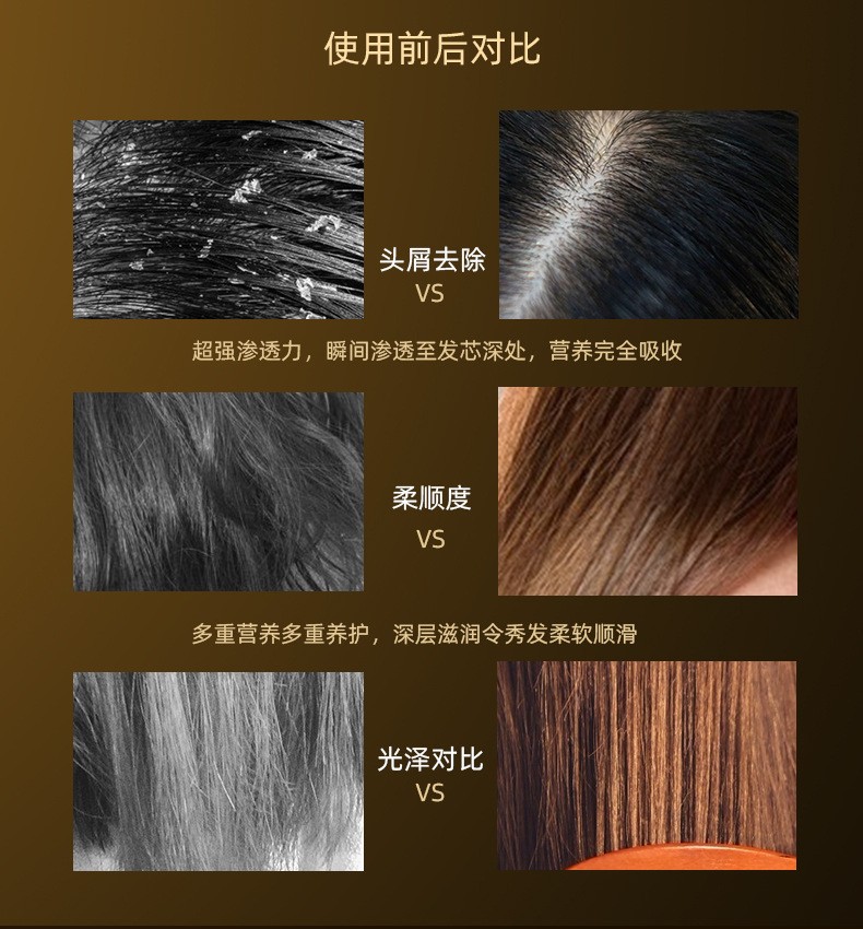 花月情头发去屑精华素干枯受损发质轻盈柔顺持久顺滑染烫修护保湿顺滑