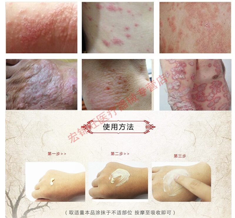 鼎医生抑菌乳膏15g皮肤骚痒肛门痒阴部痒阴囊潮湿男女阴痒霜妇科私处